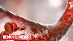 Hemofilide 'Kritik Saatler': Hayatı Tehdit Eden İç Kanama Sinyalleri Mühürlendi - Sağlık Haber