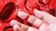 Hemofilide 'Gizli' Tehlike: Büyük Kas Gruplarında Sarsıcı Kanama Silsilesi - Sağlık Haber